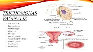 Trichomonas vaginalis [upl. by Arhoz]