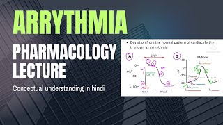 Treatment of Cardiac arrhythmia Pharmacology lectures Cardio vascular system pharmacologylectures [upl. by Obediah]