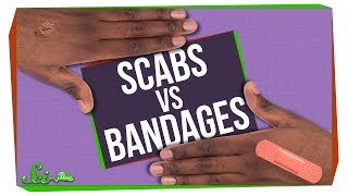 Whats Better for Wounds Scabs or Bandages [upl. by Aratak]