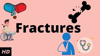 Fractures Causes Signs and Symptoms Diagnosis and Treatment [upl. by Aibara695]