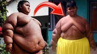 The World’s Fattest Boy Has Lost 70lbs After Life Saving Surgery [upl. by Akiret852]