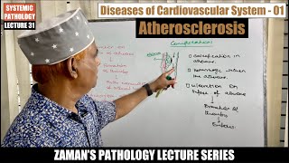 Systemic Pathology Lecture 31  Diseases of CVS  Day 01  Atherosclerosis [upl. by Anawek]