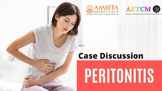 Case Discussion  Peritonitis [upl. by Canotas]