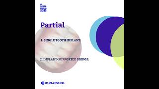 Types of Dental Implants [upl. by Lzeil]