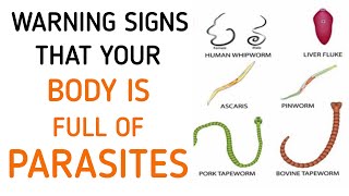 Dont Ignore These Early Symptoms Of Parasites In Your Body [upl. by Vedette328]