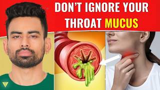 How to Clear Excess Throat Mucus [upl. by Ahsemak732]