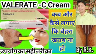 Valerate c cream ke fayde  valerate c cream uses in hindi  uses of valerate c cream  valerate c [upl. by Ecirtram233]