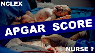 APGAR SCORE  How to check APGAR score  Apgar score assessment  Apgar score newborn [upl. by Uok507]