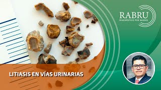 LITIASIS EN VIAS URINARIAS [upl. by Nnovahs815]