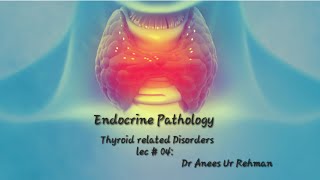 Neoplasms of Thyroid concept robbinpathology urdu [upl. by O'Driscoll]