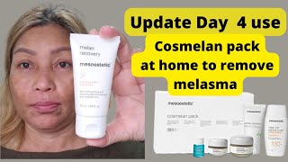 Day 4 update used Cosmelan 2 how to use the cream [upl. by Mij572]