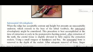 preprosthetic surgical considrations [upl. by Ecilayram]