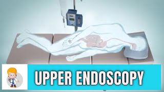 Upper GI endoscopy Esophagogastroduodenoscopy Animation 3D [upl. by Ahsirhcal905]