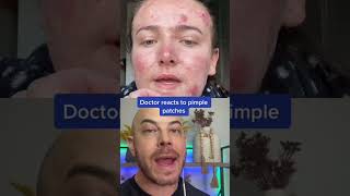 Derm recats to pimple patch removal pimplepopper dermreacts doctorreacts [upl. by Hamo910]