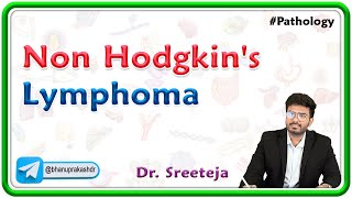 20 Non Hodgkins Lymphoma  USMLE Step 1 Pathology [upl. by Anewor]