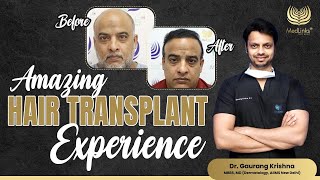 Amazing Hair Transplant Journey  Best Hair Transplant Result  MedLinks [upl. by Odlareg]