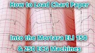 How to Load Chart Paper in the Mortara ELI 150 amp 250 ECG Machines [upl. by Atteloj494]