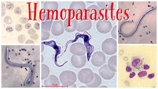 Hemoparasites pathology pathologylab hematology smear parasite [upl. by Eceirehs]