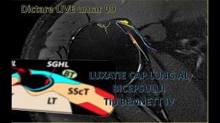 dictare live umar 09 ro [upl. by Annabela]