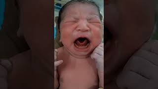 New Born Baby after birth loudly crying viralvideocute baby [upl. by Gautea919]