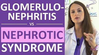 Nephrotic Syndrome vs Glomerulonephritis  Nephritic vs Nephrotic Syndrome Nursing NCLEX [upl. by Schilt791]