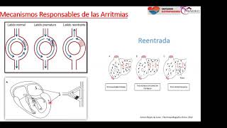 12  Extrasístoles auriculares y ventriculares [upl. by Derrik]