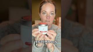 Is This Crème the Solution for Dry Eczema skin [upl. by Lesh]