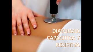 Diatermia Capacitiva y Resistiva [upl. by Dib595]