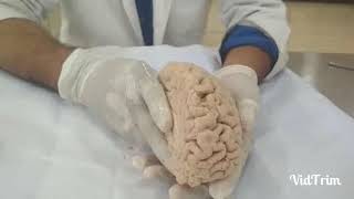 Internal capsule of Brain  Neuroanatomy [upl. by Yortal]