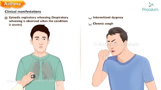 Asthma  Etiology Pathogenesis Clinical features Diagnosis and Treatment [upl. by Koran206]