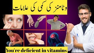 Signs your body is deficient in vital nutrients amp vitamins  vitamins deficiency symptoms [upl. by Annovaj820]