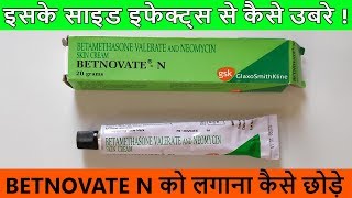 Betnovate N Cream को लगाना कैसे छोड़े  Side Effects से कैसे उबरे [upl. by Lohman]