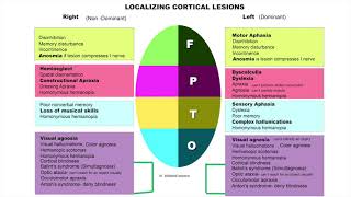 Localising cortical lesions for medical students [upl. by Nellac]