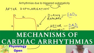 Mechanisms of cardiac arrhythmias  Tachyarrhythmias  Cardiovascular Pathophysiology [upl. by Tterag436]