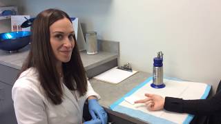 Wart Removal Using Liquid Nitrogen [upl. by Gillman]