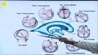 Microscopic and Endoscopic anatomy of the ventricles and their approaches [upl. by Rotciv961]