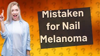 What can be mistaken for nail melanoma [upl. by Nedda]