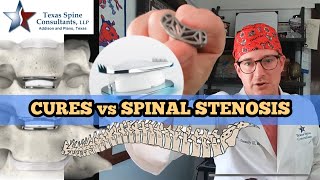 Can spine stenosis be cured [upl. by Nialb]