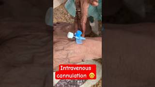 Intravenous cannulation  ivtherapy ivcannulation trending shorts SMpharmacy plz subscribe [upl. by Zug212]