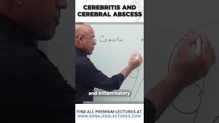 Cerebritis And Cerebral Abscess drnajeeb drnajeeblectures shortvideostatus [upl. by Amos]