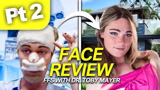 Facial Feminization Surgery with Dr Toby Mayer Pt 2 [upl. by Enilreug466]