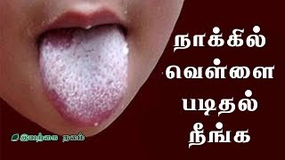 நாக்கில் வெள்ளை படிதல்  White Coated Tongue  Tongue White Coating Tamil [upl. by Weil]