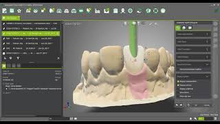 Variobase® for Crown AS [upl. by Nezam838]