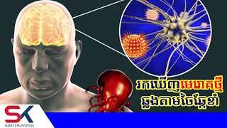 Breaking អង់គ្លេសរកឃើញមេរោគថ្មីមួយ ឆ្លងតាមរយៈចៃឆ្កែ [upl. by Barney]