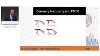 Unifocal and multifocal FMD Two different disease entities in a single patient [upl. by Stone660]