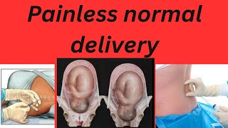 Painless normal delivery pregnancy labour painlessdeliverypregnancy [upl. by Wilhide]