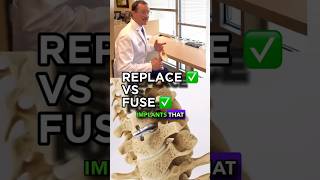 Spine fusion vs spine replacement Texan spine surgeon explains 🤗🤠 [upl. by Felten]