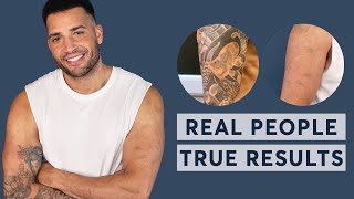 Laser Tattoo Removal  Real People True Results 2023 [upl. by Annahael]