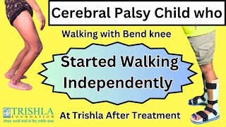 Dystonic Diplegic Cerebral Palsy with Crouch Gait got Excellent Walking Capability after treatment [upl. by Tonya]