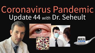 Coronavirus Pandemic Update 44 Loss of Smell amp Conjunctivitis in COVID19 Is Fever Helpful [upl. by Naneek956]